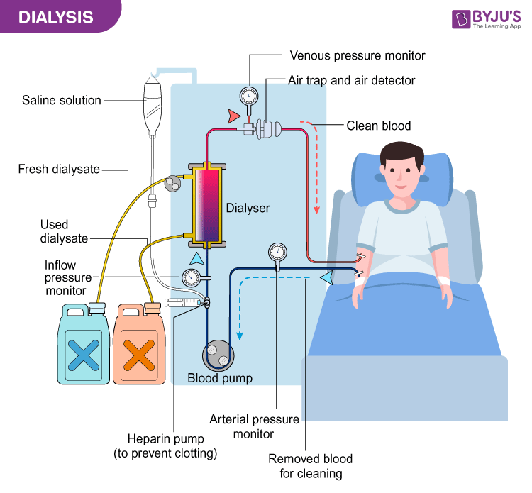 Dialysis